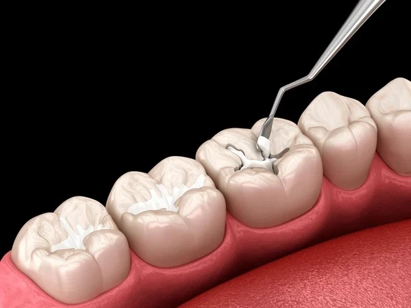 Dental Equipment